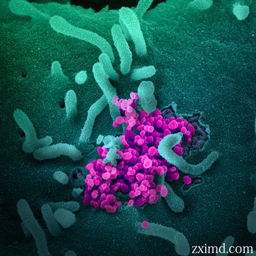 顯微鏡下的新型冠狀病毒COVID-19圖片